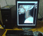 Advanced Barco Monitors for Radiology reporting